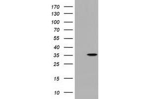 Image no. 1 for anti-Peroxisomal Trans-2-Enoyl-CoA Reductase (PECR) antibody (ABIN1500148) (PECR 抗体)