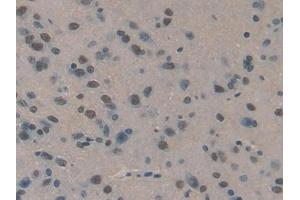 Detection of HCII in Rat Brain Tissue using Polyclonal Antibody to Heparin Cofactor II (HCII)