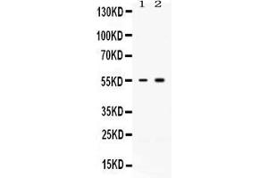 Western blot analysis of ACVR2B expression in rat skeletal muscle extract ( Lane 1) and MCF-7 whole cell lysates ( Lane 2). (ACVR2B 抗体  (C-Term))