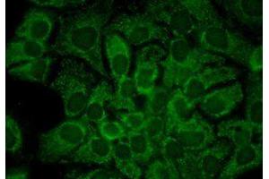 Hsp90 alpha Immunofluorescence.