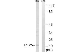 Western blot analysis of extracts from 293 cells, using MRPS25 antibody. (MRPS25 抗体  (C-Term))