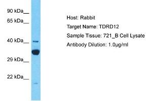 Host: Rabbit Target Name: TDRD12 Sample Type: 721_B Whole Cell lysates Antibody Dilution: 1. (TDRD12 抗体  (C-Term))