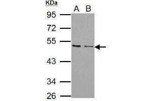 WB Image Sample (30 ug of whole cell lysate) A: PC-3 B: U87-MG 10% SDS PAGE antibody diluted at 1:1000 (CXCR7 抗体)