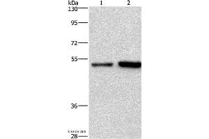 Western blot analysis of Hela and Jurkat cell, using SYT4 Polyclonal Antibody at dilution of 1:700 (SYT4 抗体)