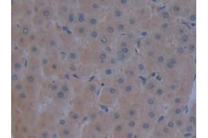 Detection of C3 in Human Liver Tissue using Polyclonal Antibody to Complement Component 3 (C3) (C3 抗体  (AA 1000-1326))