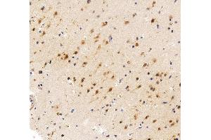 IHC analysis of FGF2 using anti-FGF2 antibody (ABIN7603215). (FGF2 抗体  (N-Term))