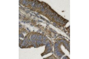 IHC analysis of REA/PHB2 using anti REA/PHB2 antibody (ABIN7599240). (Prohibitin 2 抗体  (AA 1-299))