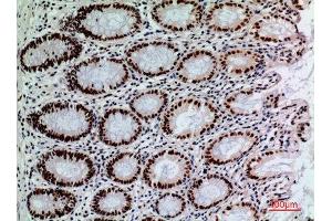 Immunohistochemistry (IHC) analysis of paraffin-embedded Human Colon, antibody was diluted at 1:100. (SLAMF1 抗体  (Tyr1096))