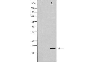 Western blot analysis of p18 INK expression in Cos7 cell extract. (P18 INK 抗体)