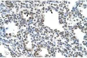 Rabbit Anti-NKD1 Antibody  Paraffin Embedded Tissue: Human Lung Cellular Data: Alveolar cells Antibody Concentration: 4. (NKD1 抗体  (N-Term))