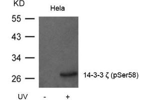 Western blot analysis of extracts from Hela cells untreated or treated with UV using 14-3-3z(Phospho-Ser58) Antibody.