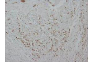 Immunohistochemical analysis of paraffin embedded Human tissue sections (ovary) using Myeloperoxidase antibody (Myeloperoxidase 抗体  (C-Term))