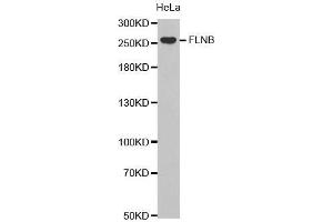 Western Blotting (WB) image for anti-Filamin B, beta (FLNB) (AA 1686-1785) antibody (ABIN6219554) (FLNB 抗体  (AA 1686-1785))
