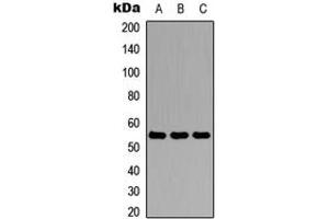 Western blot analysis of Antithrombin III expression in HEK293T (A), Raw264. (SERPINC1 抗体  (N-Term))