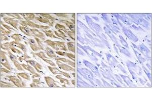Immunohistochemistry analysis of paraffin-embedded human heart tissue, using MRPL39 Antibody. (MRPL39 抗体  (AA 289-338))