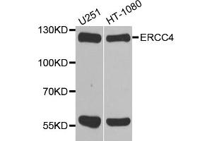 Western blot analysis of extracts of various cell lines, using ERCC4 antibody. (ERCC4 抗体)