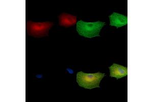 ABIN7097065 and ABIN7101132 staining  cells by IF/ICC. (GGN 抗体)