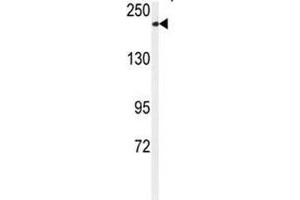 Western Blotting (WB) image for anti-Transient Receptor Potential Cation Channel, Subfamily M, Member 7 (TRPM7) (AA 1821-1850) antibody (ABIN3029239)