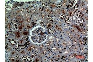 Immunohistochemistry (IHC) analysis of paraffin-embedded Human Kidney, antibody was diluted at 1:100. (Catalase 抗体  (C-Term))