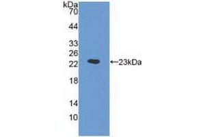 Detection of Recombinant a1AGP, Human using Monoclonal Antibody to Alpha-1-Acid Glycoprotein (a1AGP) (ORM1 抗体  (AA 19-201))