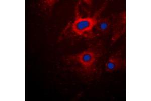 Immunofluorescent analysis of Cytokeratin 8 staining in HeLa cells.