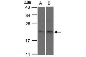 WB Image Sample(30 μg of whole cell lysate) A:293T B:H1299 15% SDS PAGE antibody diluted at 1:1500 (SNX12 抗体  (C-Term))