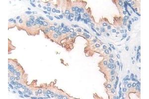Detection of PMSA in Human Prostate Tissue using Polyclonal Antibody to Prostate-specific Membrane Antigen (PMSA) (PSMA 抗体  (AA 274-587))