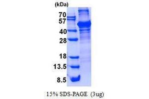 Figure annotation denotes ug of protein loaded and % gel used. (LCAT 蛋白)