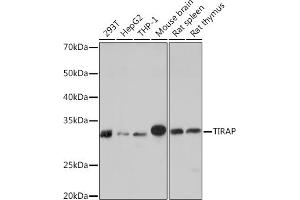 Western blot analysis of extracts of various cell lines, using TIRAP Rabbit mAb (ABIN7270842) at 1:1000 dilution. (TIRAP 抗体)