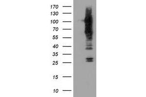 Western Blotting (WB) image for anti-Transforming, Acidic Coiled-Coil Containing Protein 3 (TACC3) antibody (ABIN1498101) (TACC3 抗体)