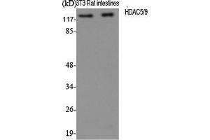 Western Blot (WB) analysis of specific cells using HDAC5/9 Polyclonal Antibody. (HDAC5/9 (Ser1177) 抗体)