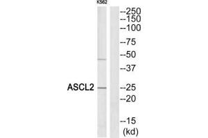 Western Blotting (WB) image for anti-Achaete-Scute Complex Homolog 2 (ASCL2) (Internal Region) antibody (ABIN1849922) (ASCL2 抗体  (Internal Region))