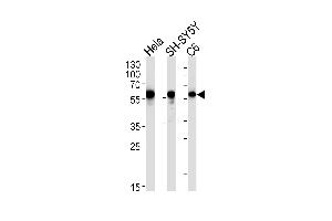 Western blot analysis in Hela,SH-SY5Y,rat C6 cell line lysates (35ug/lane). (GOPC 抗体)
