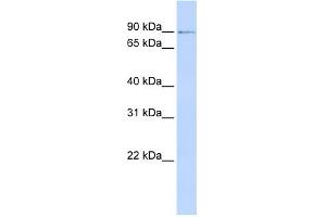 WB Suggested Anti-ZNF263 Antibody Titration: 0. (ZNF263 抗体  (N-Term))