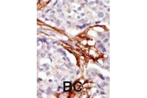 Immunohistochemistry (IHC) image for anti-V-Yes-1 Yamaguchi Sarcoma Viral Oncogene Homolog 1 (YES1) antibody (ABIN3003458) (YES1 抗体)