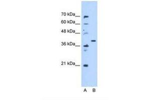 Image no. 1 for anti-Enoyl CoA Hydratase Domain Containing 3 (ECHDC3) (AA 71-120) antibody (ABIN341636) (ECHDC3 抗体  (AA 71-120))