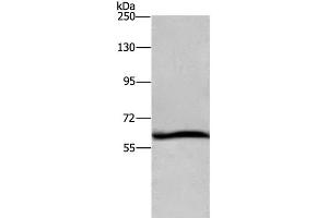 Western Blot analysis of Hela cell using DCP1A Polyclonal Antibody at dilution of 1:1100 (DCP1A 抗体)