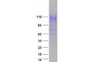 Western Blotting (WB) image for Solute Carrier Family 12 (Sodium/Chloride Transporters), Member 3 (SLC12A3) (Transcript Variant 1) protein (Myc-DYKDDDDK Tag) (ABIN2732145)