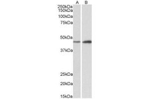 AP23754PU-N NDRG2 antibody staining of of Mouse (A) and Rat (B) Brain lysates at 0. (NDRG2 抗体  (N-Term))