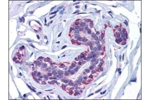 Human Breast: Formalin-Fixed, Paraffin-Embedded (FFPE) (FREM2 抗体)