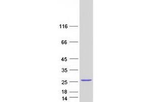 Western Blotting (WB) image for Nudix (Nucleoside Diphosphate Linked Moiety X)-Type Motif 1 (NUDT1) (Transcript Variant 2B) protein (Myc-DYKDDDDK Tag) (ABIN2727724)