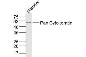 Mouse Bladder lysates probed with Pan Cytokeratin Polyclonal Antibody, Unconjugated  at 1:300 dilution and 4˚C overnight incubation. (Cytokeratin 1 抗体  (AA 141-240))