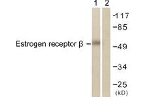 Western blot analysis of extracts from HeLa cells, treated with EGF 200ng/ml 30', using Estrogen Receptor-beta (Ab-105) Antibody. (ESR2 抗体  (AA 71-120))