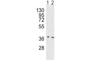 Western blot analysis of OGG1 antibody and human HeLa (lane 1), mouse NIH3T3 (2) lysate (OGG1 抗体  (AA 318-345))