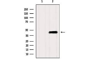 Western blot analysis of extracts from Mouse brain, using ASBT Antibody. (SLC10A2 抗体  (C-Term))