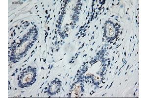 Immunohistochemical staining of paraffin-embedded breast using anti-EpCAM (ABIN2452677) mouse monoclonal antibody. (EpCAM 抗体  (AA 24-265))