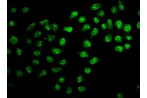Immunofluorescence staining of Hela cells with ABIN7176167 at 1:166, counter-stained with DAPI. (ZNF224 抗体  (AA 477-607))