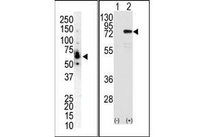 (LEFT)Western blot analysis of anti-PKC eta N-term Pab in NCI-H460 cell lysate. (PKC eta 抗体  (N-Term))