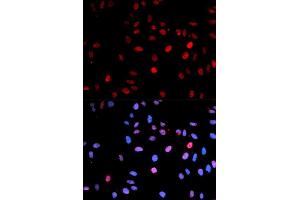 Immunofluorescence (IF) image for anti-Tumor Protein P53 (TP53) (pSer15) antibody (ABIN3023601) (p53 抗体  (pSer15))