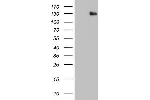 Western Blotting (WB) image for anti-ADAM Metallopeptidase with Thrombospondin Type 1 Motif, 1 (ADAMTS1) (AA 412-644) antibody (ABIN2715715) (ADAMTS1 抗体  (AA 412-644))